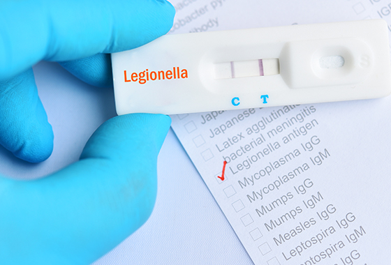 Legionella Image