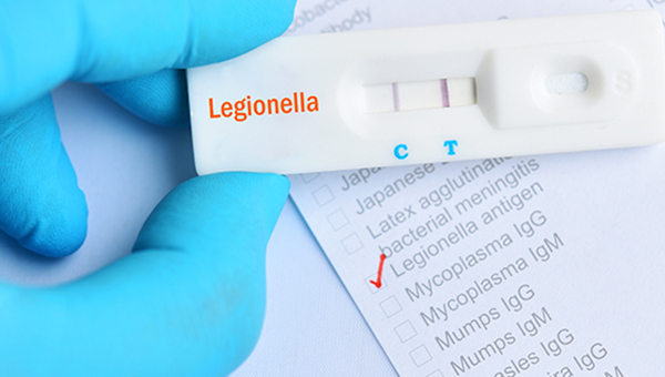 Preventing Legionella in Swimming Pools: Best Practices for Safe, Compliant Facilities
